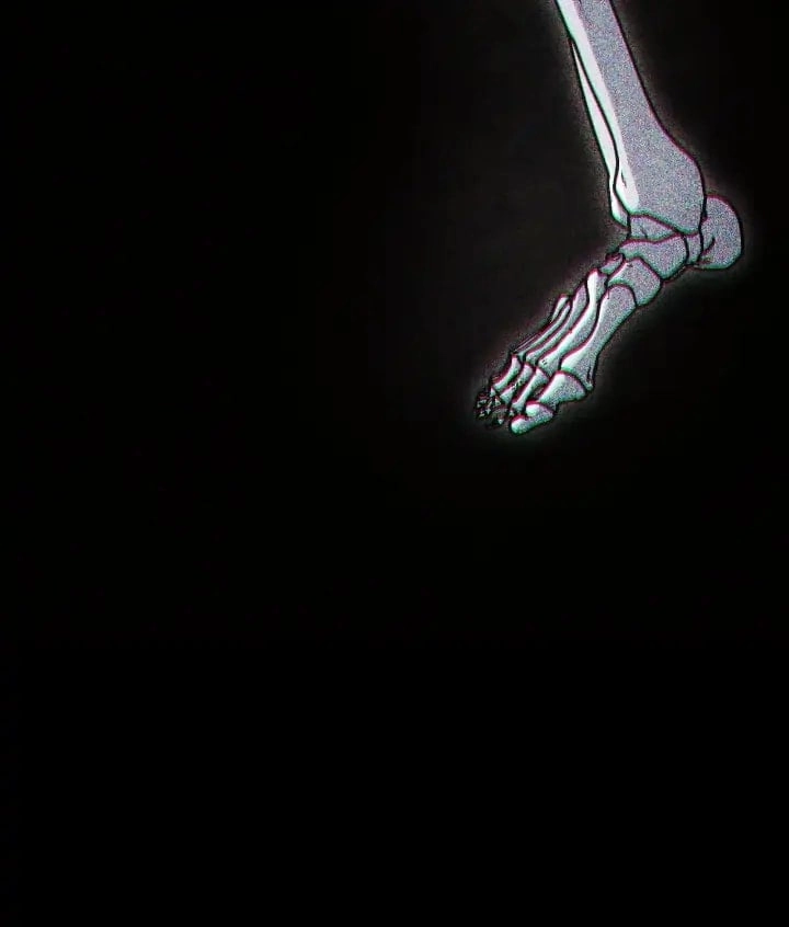 The Skeleton Soldier Failed to Defend the Dungeon Chapter 224 - Page 3